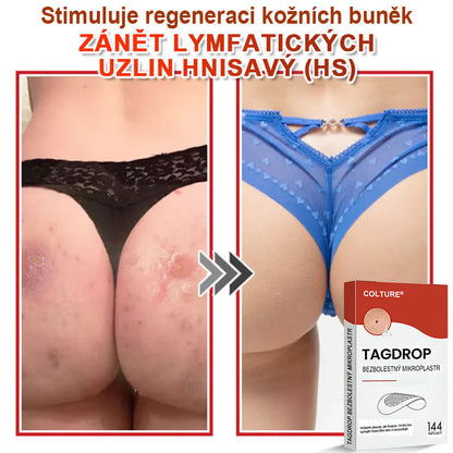 🎆COLTURE® Mikrovpichová botanická náplast na odstranění kožních výrůstků✨✨