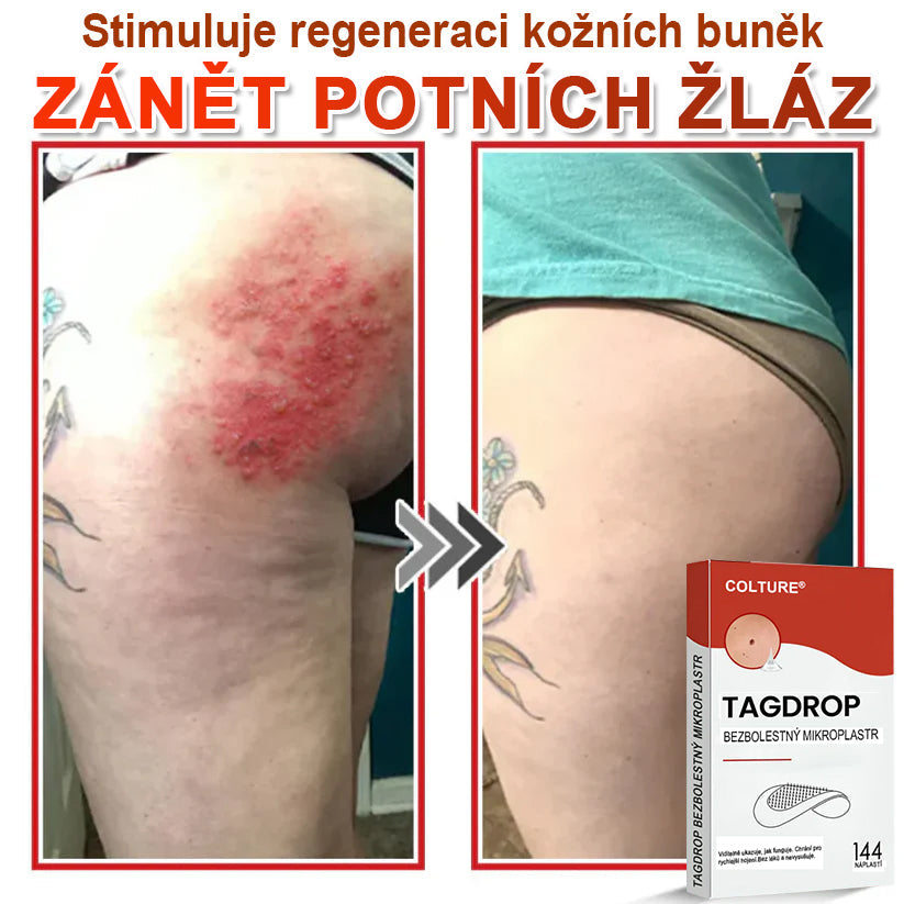 🎆COLTURE® Mikrovpichová botanická náplast na odstranění kožních výrůstků✨✨