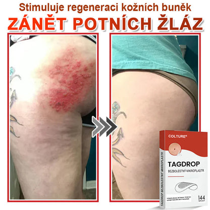 🎆COLTURE® Mikrovpichová botanická náplast na odstranění kožních výrůstků✨✨