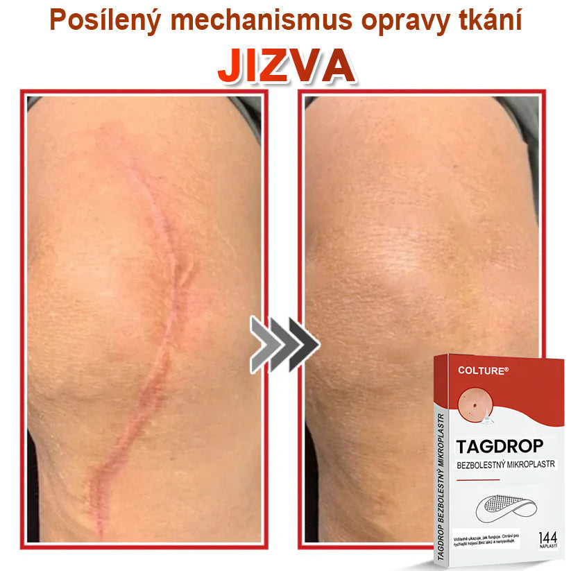 🎆COLTURE® Mikrovpichová botanická náplast na odstranění kožních výrůstků✨✨