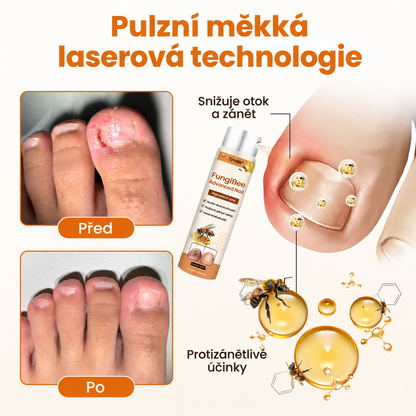 Sprej na opravu nehtů Timilk® FungiBee Advanced⭐️