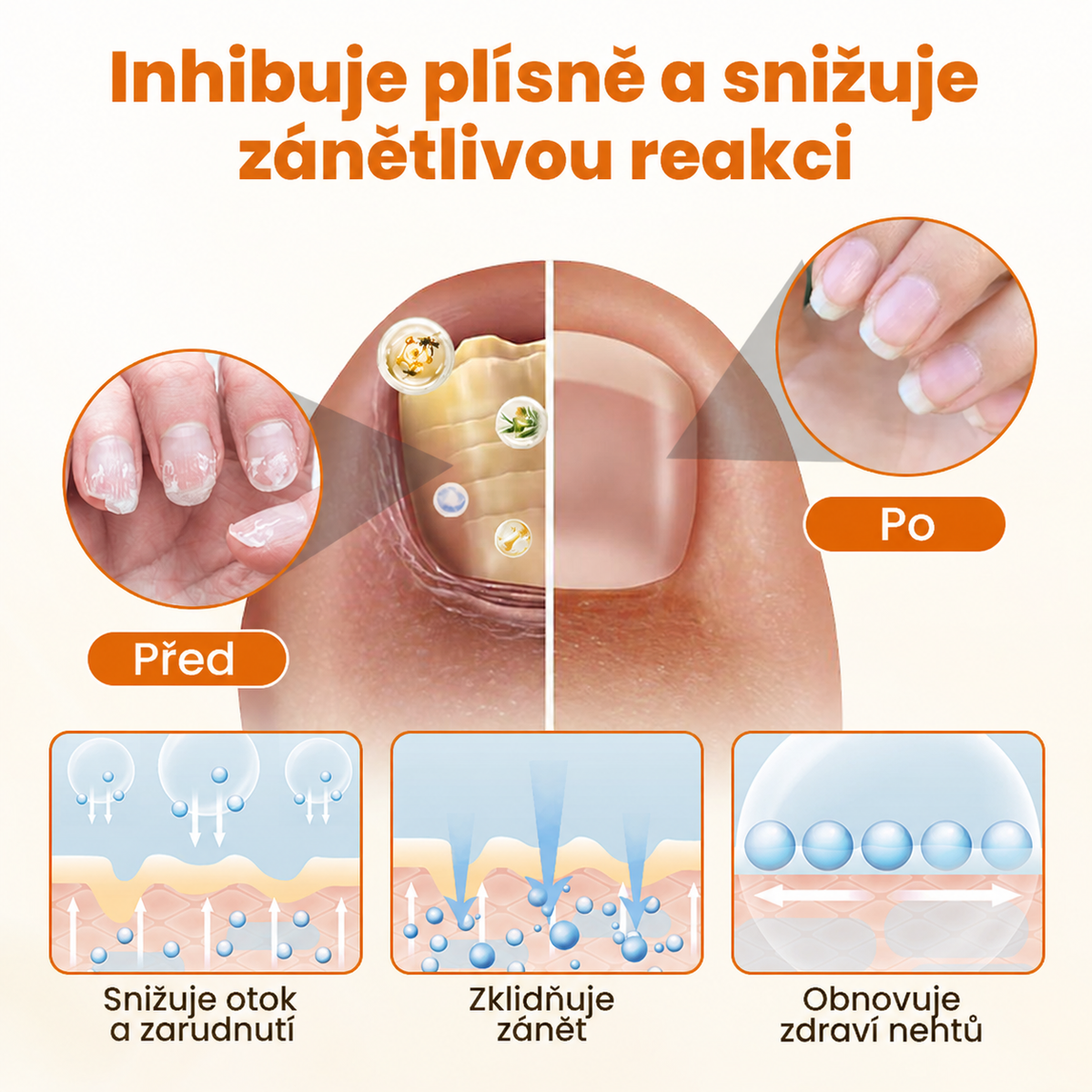 Sprej na opravu nehtů Timilk® FungiBee Advanced⭐️