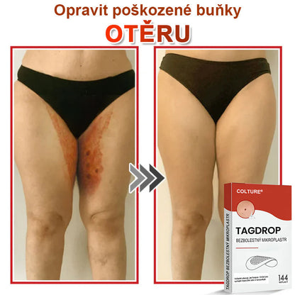 🎆COLTURE® Mikrovpichová botanická náplast na odstranění kožních výrůstků✨✨