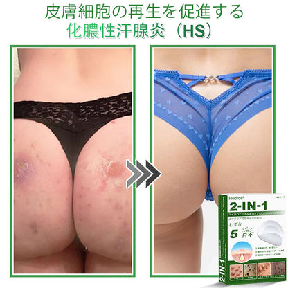 本日限定80%OFF📌 Hudros® 2in1 マイクロニードル＆ハイドロコロイドパッチ｜ニキビ・肌荒れ・肌悩みを集中ケア｜目立ちにくい星型パッチ｜顔・ボディ用｜144枚入り