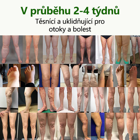 Řekněte sbohem oteklým, bolestivým nohám – CleraNaure® FluidEase Profesionální krém pro prokrvení nohou přináší skutečnou úlevu!🦵