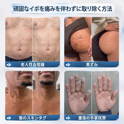 😆 サプライズ！！！Trilumia® 2本目を70%OFFでご購入いただけます！