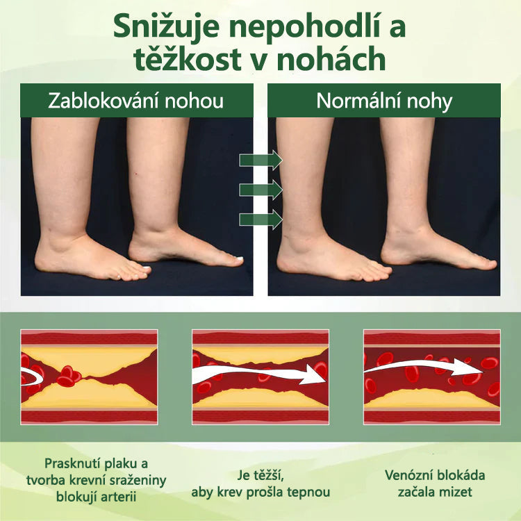 Řekněte sbohem oteklým, bolestivým nohám – CleraNaure® FluidEase Profesionální krém pro prokrvení nohou přináší skutečnou úlevu!🦵
