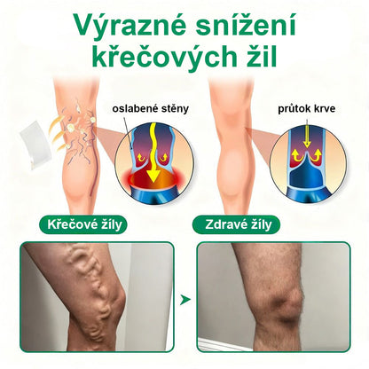 🔥Twisma® VeinTarget – Pokročilá mikro náplast na křečové žíly 🔥 96 % klinicky prokázaná účinnost ⚡ Viditelné výsledky už za 7–14 dní 🌿 Šetrná podpora pro lehčí a uvolněnější nohy 🦵✨