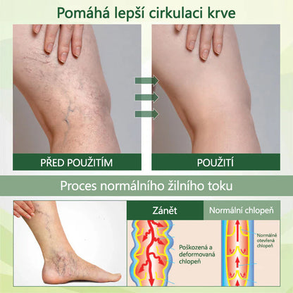 Řekněte sbohem oteklým, bolestivým nohám – CleraNaure® FluidEase Profesionální krém pro prokrvení nohou přináší skutečnou úlevu!🦵