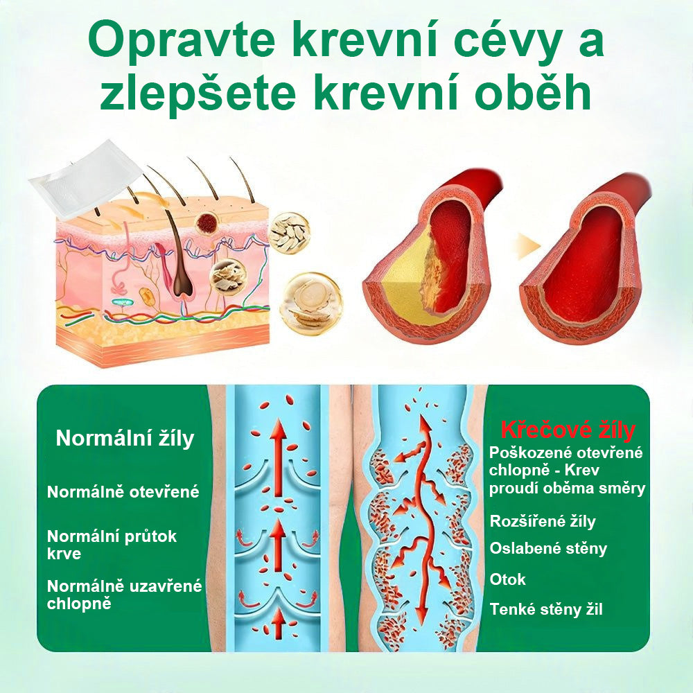 🔥Twisma® VeinTarget – Pokročilá mikro náplast na křečové žíly 🔥 96 % klinicky prokázaná účinnost ⚡ Viditelné výsledky už za 7–14 dní 🌿 Šetrná podpora pro lehčí a uvolněnější nohy 🦵✨