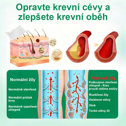 🔥Twisma® VeinTarget – Pokročilá mikro náplast na křečové žíly 🔥 96 % klinicky prokázaná účinnost ⚡ Viditelné výsledky už za 7–14 dní 🌿 Šetrná podpora pro lehčí a uvolněnější nohy 🦵✨