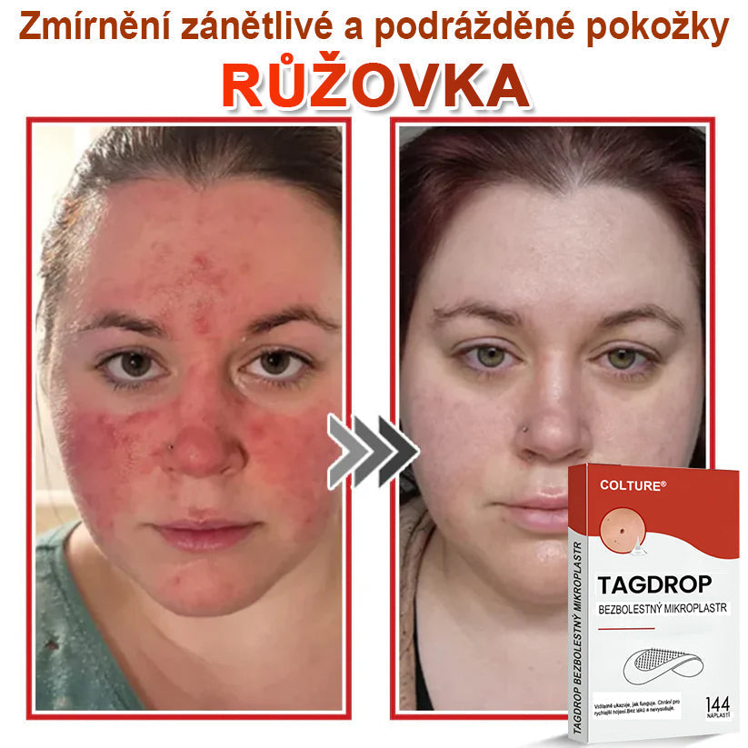 🎆COLTURE® Mikrovpichová botanická náplast na odstranění kožních výrůstků✨✨