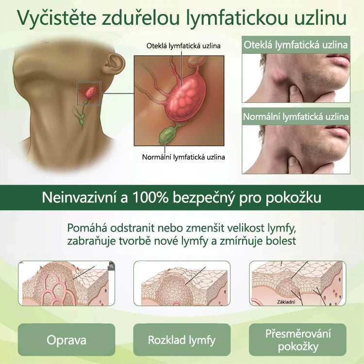 Řekněte sbohem oteklým, bolestivým nohám – CleraNaure® FluidEase Profesionální krém pro prokrvení nohou přináší skutečnou úlevu!🦵