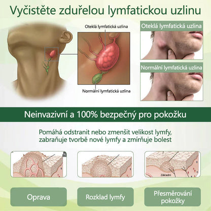 Řekněte sbohem oteklým, bolestivým nohám – CleraNaure® FluidEase Profesionální krém pro prokrvení nohou přináší skutečnou úlevu!🦵