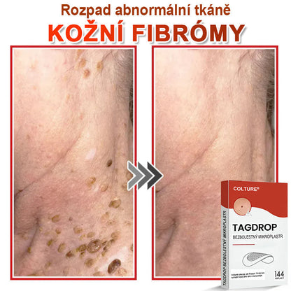 🎆COLTURE® Mikrovpichová botanická náplast na odstranění kožních výrůstků✨✨