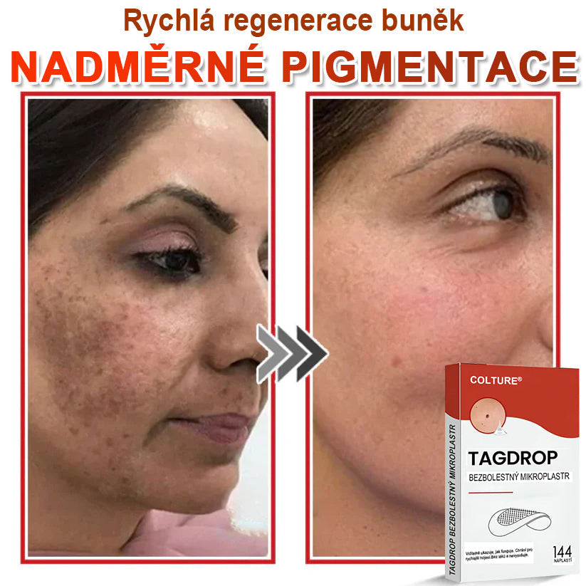 🎆COLTURE® Mikrovpichová botanická náplast na odstranění kožních výrůstků✨✨